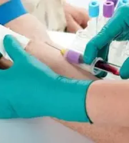 esami-sangue-poliambulatorio-san-gaetano